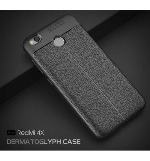Xiaomi  4X Case slim fit TPU Soft Gel Case