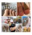Ingrown Toe nail Correction Onychocryptosis appliance Coil corrector