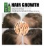 Ginger Serum Spray Hair Loss Hair Thinning Treatment 100ml