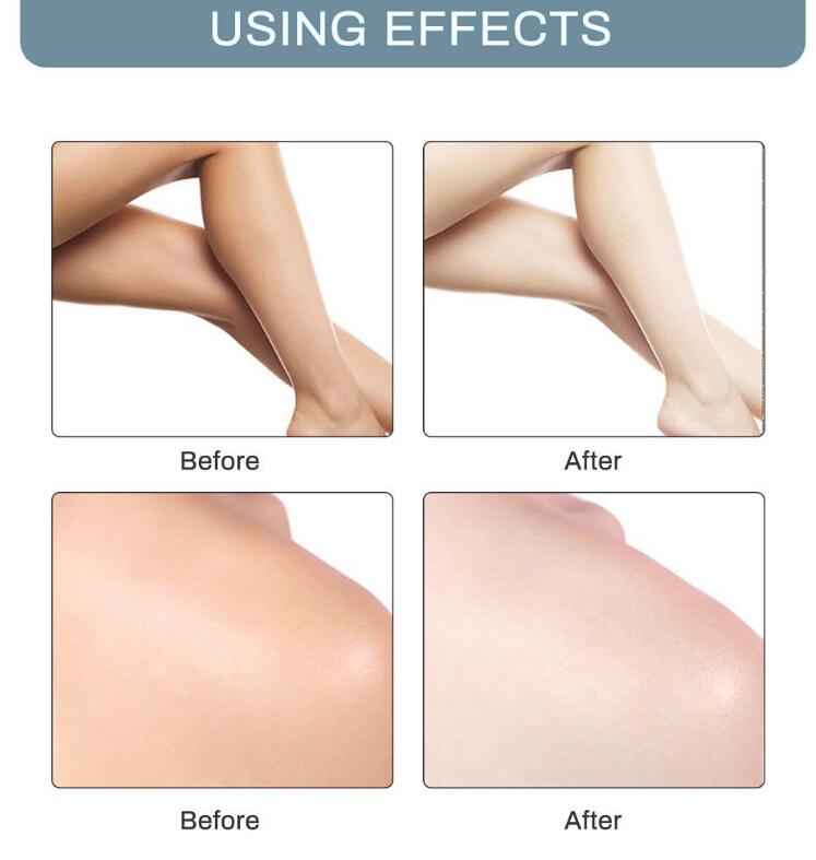 Bellezon Underarm Whitening Cream