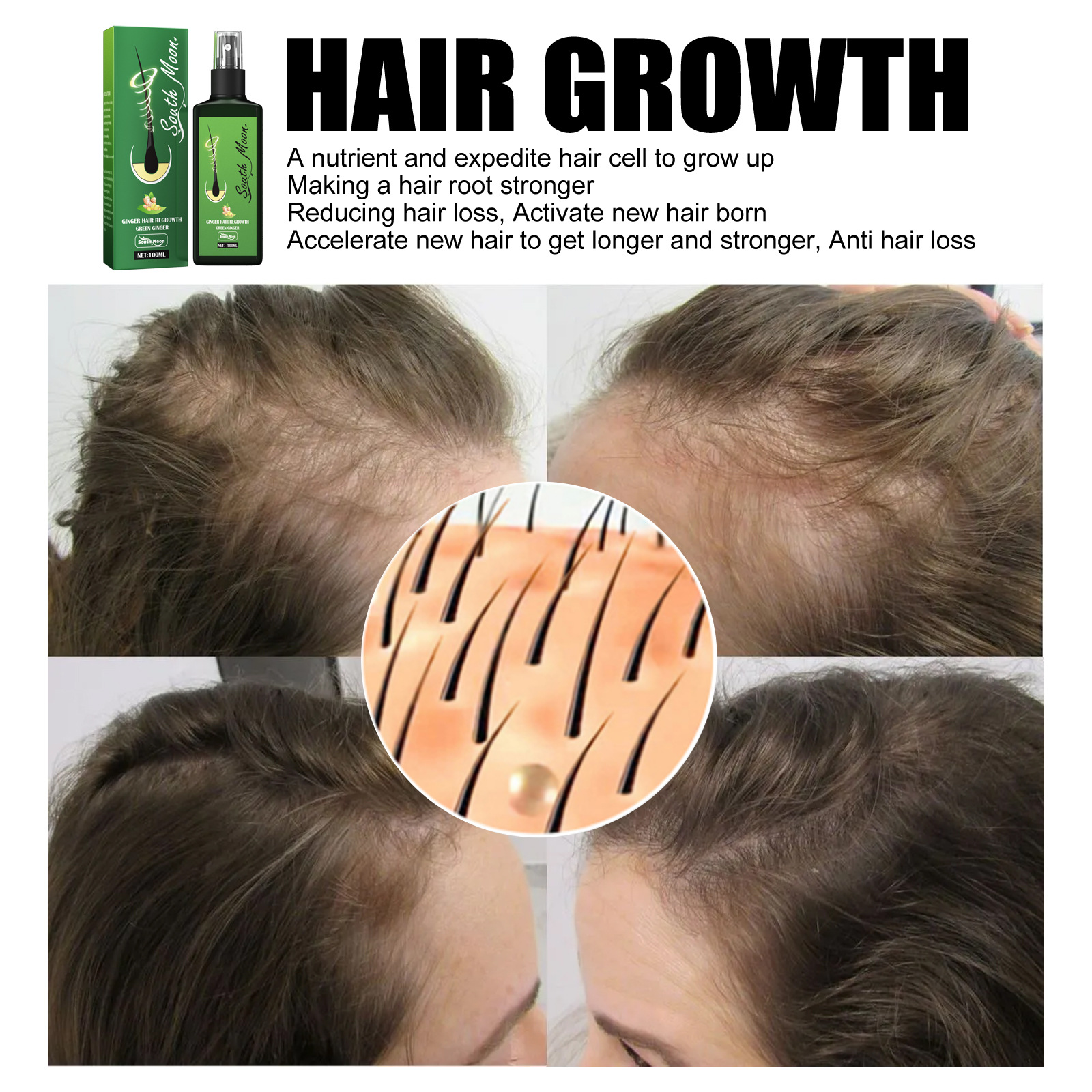 Ginger Serum Spray Hair Loss Hair Thinning Treatment 100ml