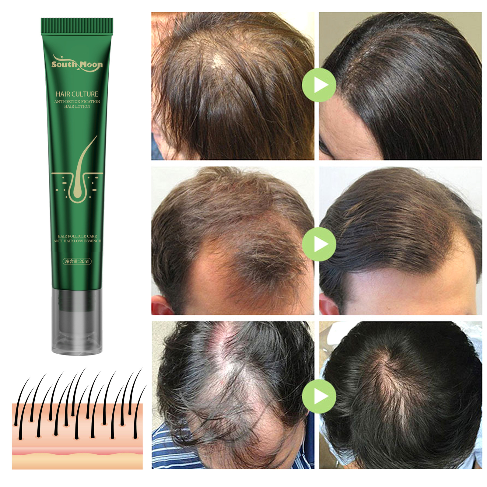 Hair Growth Essence Strengthens Hair Anti-break And Root Damage Hair Growth Essence Strengthens Hair Anti-break And Root Damage