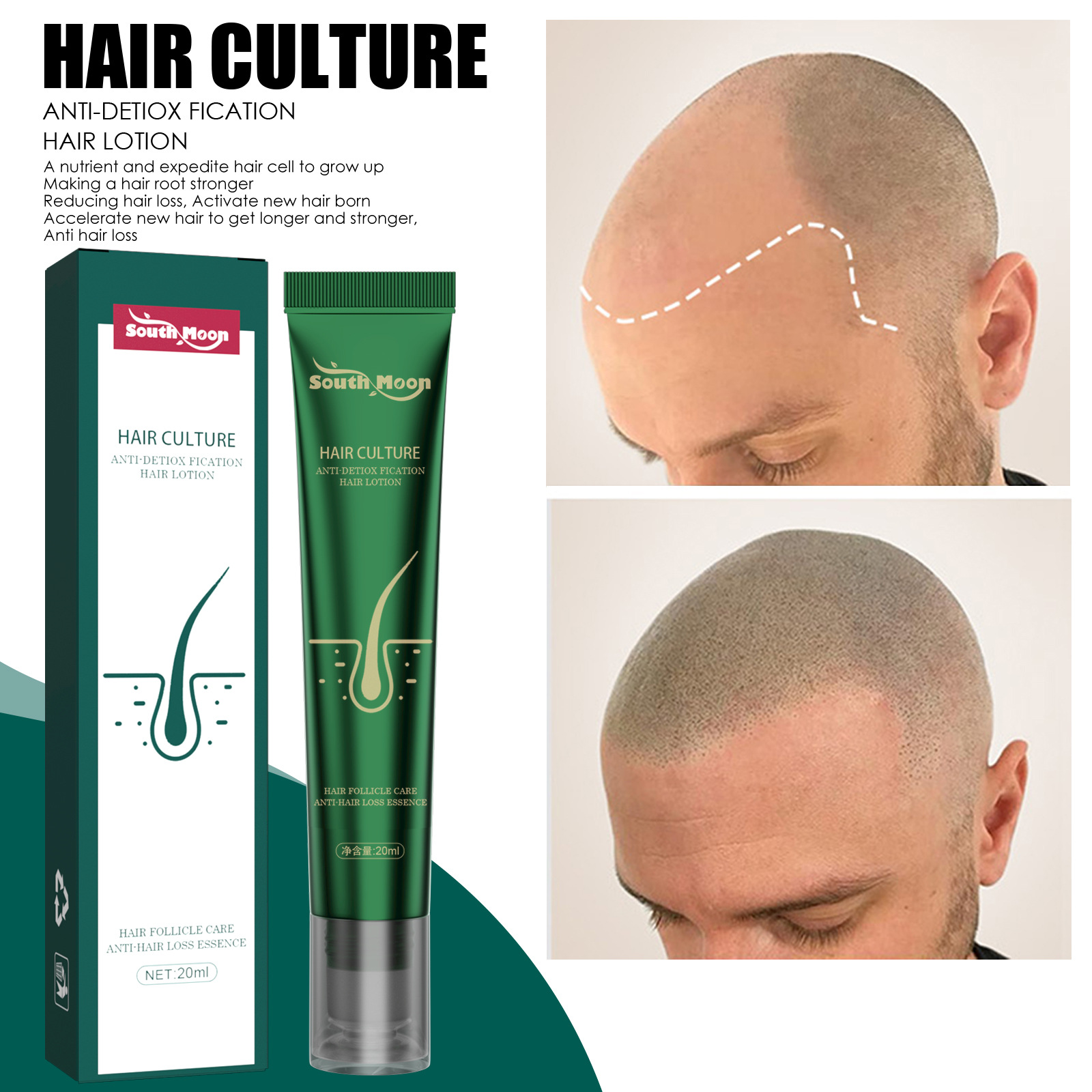 Hair Growth Essence Strengthens Hair Anti-break And Root Damage Hair Growth Essence Strengthens Hair Anti-break And Root Damage