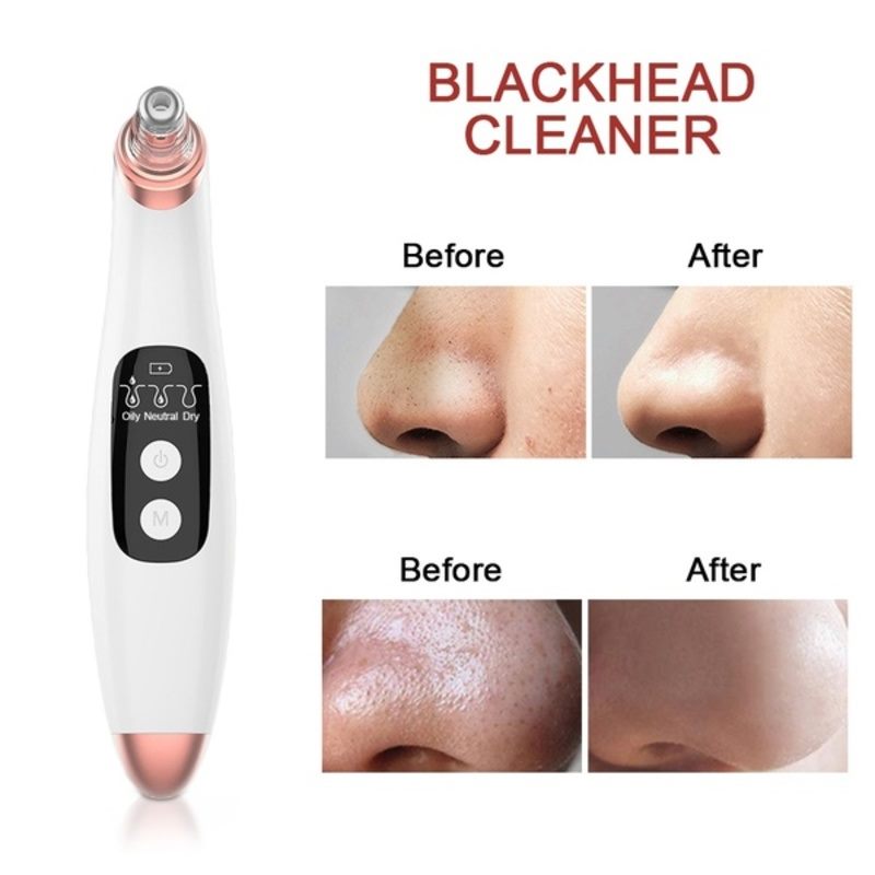 Blackhead Remover Black Head Remover